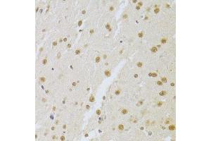 Immunohistochemistry (Paraffin-embedded Sections) (IHC (p)) image for anti-Small Nuclear Ribonucleoprotein Polypeptide A (SNRPA) (AA 1-282) antibody (ABIN6148210)