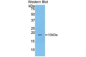 Detection of Recombinant PHLDA2, Mouse using Polyclonal Antibody to Pleckstrin Homology Like Domain Family A, Member 2 (PHLDA2) (PHLDA2 antibody  (AA 9-140))