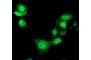 Anti-SHPK mouse monoclonal antibody (ABIN2454861) immunofluorescent staining of COS7 cells transiently transfected by pCMV6-ENTRY SHPK (RC204421). (SHPK antibody)