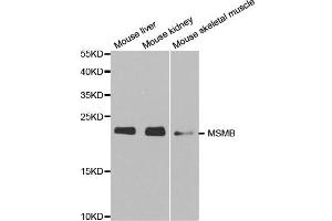 Western blot analysis of extracts of various cell lines, using MSMB antibody. (MSMB antibody)