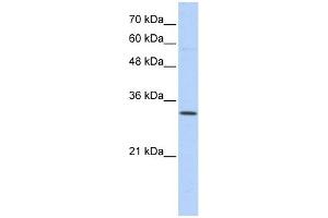 Sideroflexin 1 antibody used at 1 ug/ml to detect target protein. (SFXN1 antibody  (N-Term))