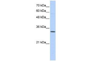 Sideroflexin 1 antibody used at 1 ug/ml to detect target protein.