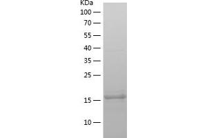 SDPR Protein (AA 52-195) (His tag)