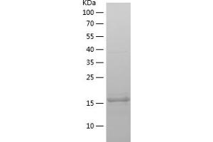 SDPR Protein (AA 52-195) (His tag)