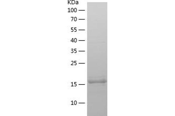 SDPR Protein (AA 52-195) (His tag)