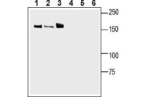 Western blot analysis of rat brain membranes (lanes 1 and 4), rat dorsal root ganglion lysate (lanes 2 and 5) and mouse brain membranes (lanes 3 and 6):1-3. (Leptin Receptor antibody  (Extracellular))