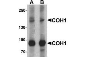 Western blot analysis of COH1 in SK-N-SH cell lysate with COH1 Antibody  antibody at (A) 1 and (B) 2 μg/ml. (VPS13B antibody  (N-Term))