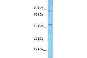 Host:  Rabbit  Target Name:  SIM2  Sample Type:  A549 Whole Cell lysates  Antibody Dilution:  1. (SIM2 antibody  (Middle Region))