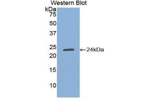 Western Blotting (WB) image for anti-TIMP Metallopeptidase Inhibitor 1 (TIMP1) (AA 25-207) antibody (ABIN1078585) (TIMP1 antibody  (AA 25-207))