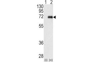 Western Blotting (WB) image for anti-Protein Kinase C, iota (PRKCI) antibody (ABIN3002935) (PKC iota antibody)