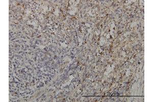 Immunoperoxidase of monoclonal antibody to GRAP2 on formalin-fixed paraffin-embedded human spleen. (GRAP2 antibody  (AA 226-315))