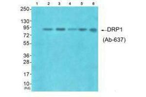 Western blot analysis of extracts from HuvEc cells (Lane 2), HepG2 cells (Lane 3), colo cells (Lane 4), 293 cells (Lane 5) and JK cells (Lane 6), using DRP1 (Ab-637) antiobdy. (Dynamin 1-Like antibody  (C-Term))