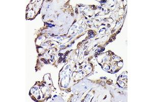 Immunohistochemistry of paraffin-embedded human placenta using GAPDH Rabbit mAb (ABIN7267454) at dilution of 1:100 (40x lens). (GAPDH antibody)