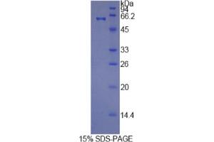 SDS-PAGE analysis of Human HRG Protein. (HRG Protein)