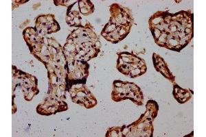 IHC image of ABIN7169168 diluted at 1:400 and staining in paraffin-embedded human placenta tissue performed on a Leica BondTM system. (RIOK2 antibody  (AA 316-448))