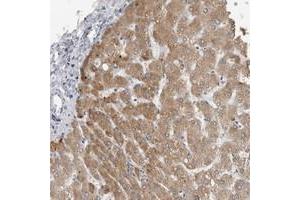 Immunohistochemical staining of human liver with PRSS38 polyclonal antibody  shows cytoplasmic positivity in hepatocytes.