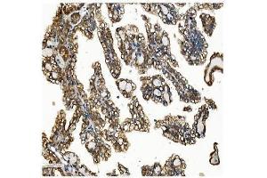 IHC analysis of VAPB using anti-VAPB antibody (ABIN5693292). (VAPB antibody  (AA 2-55))