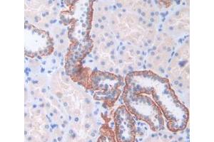 IHC-P analysis of Human Kidney Tissue, with DAB staining. (CENPI antibody  (AA 292-528))