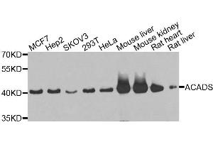 Western blot analysis of extracts of various cell lines, using ACADS antibody. (ACADS antibody  (AA 1-260))