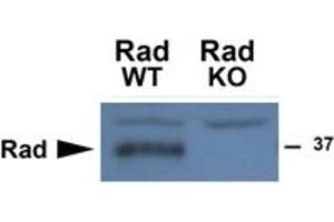 Western Blotting (WB) image for anti-Ras-Related Associated with Diabetes (RRAD) (Internal Region) antibody (ABIN2465070)