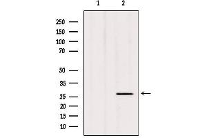 Western blot analysis of extracts from hybridoma cells, using C1QL3 Antibody. (C1QL3 antibody  (Internal Region))
