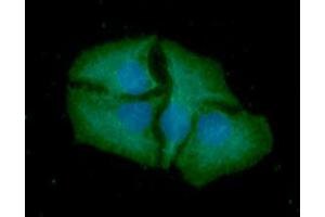ICC/IF analysis of SMAC in HeLa cells line, stained with DAPI (Blue) for nucleus staining and monoclonal anti-human SMAC antibody (1:100) with goat anti-mouse IgG-Alexa fluor 488 conjugate (Green). (DIABLO antibody  (AA 56-239))