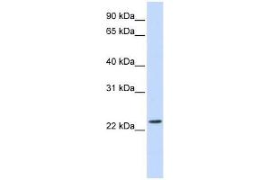 SCAND2 antibody used at 0. (SCAND2 antibody  (Middle Region))