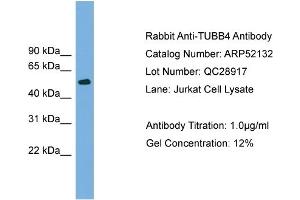 WB Suggested Anti-TUBB4  Antibody Titration: 0. (TUBB4 antibody  (N-Term))
