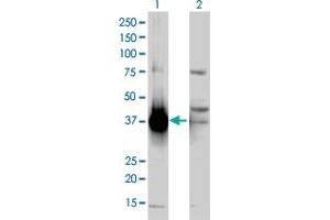Western Blot analysis of AKR1C2 expression in transfected 293T cell line by AKR1C2 polyclonal antibody (A01). (AKR1C2 antibody  (AA 224-323))