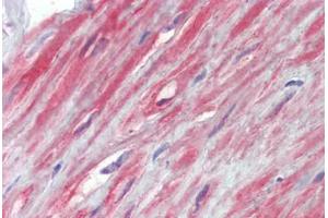 Prostate, fibromuscular stroma, Human: Formalin-Fixed, Paraffin-Embedded (FFPE) (TRPC1 antibody  (AA 722-733))