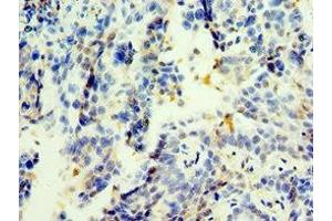 Immunohistochemistry of paraffin-embedded human lung tissue using ABIN7173394 at dilution of 1:100 (TGS1 antibody  (AA 714-853))