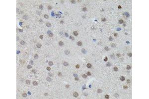 Immunohistochemistry of paraffin-embedded Mouse brain using MYCN Polyclonal Antibody (MYCN antibody)