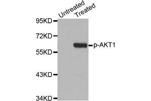 Western Blotting (WB) image for anti-V-Akt Murine Thymoma Viral Oncogene Homolog 1 (AKT1) (pSer473) antibody (ABIN6225474) (AKT1 antibody  (pSer473))