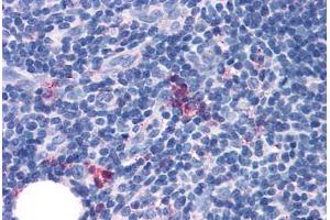 Anti-GPR97 antibody  ABIN1048901 IHC staining of human thymus, medulla. (GPR97 antibody  (Extracellular Domain))