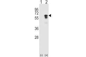 Western Blotting (WB) image for anti-Activin Receptor Type I (ACRV1) antibody (ABIN3003503) (ACVR1 antibody)