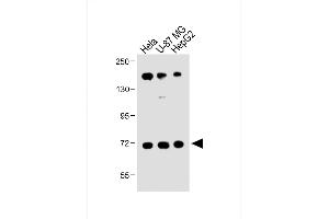 All lanes : Anti-FBXL5 Antibody (N-term) at 1:1000 dilution Lane 1: Hela whole cell lysate Lane 2: U-87 MG whole cell lysate Lane 3: HepG2 whole cell lysate Lysates/proteins at 20 μg per lane. (FBXL5 antibody  (N-Term))