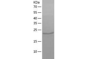 Western Blotting (WB) image for Nucleoside Diphosphate Kinase (NME7) (AA 1-228) protein (His tag) (ABIN7124226) (NME7 Protein (AA 1-228) (His tag))