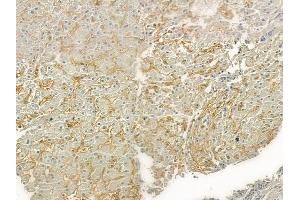 ABIN6261640 and ABIN6276821 at 1/100 staining human normal liver tissue by IHC-P. (F12 antibody  (C-Term))