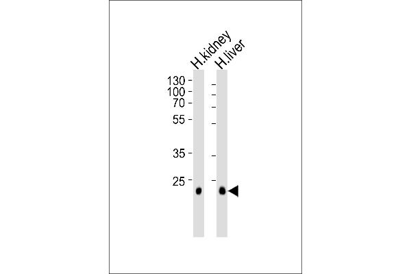 CLDN14 antibody  (C-Term)