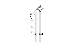 Western blot analysis of lysates from human kidney and liver tissue lysate (from left to right), using CLDN14 Antibody (C-term) (ABIN1881208 and ABIN2838931).
