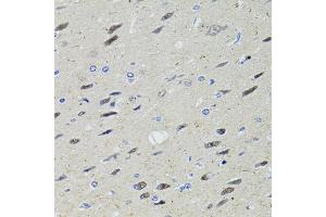 Immunohistochemistry of paraffin-embedded rat brain using STAT1 antibody (ABIN1874962) at dilution of 1:100 (40x lens). (STAT1 antibody)