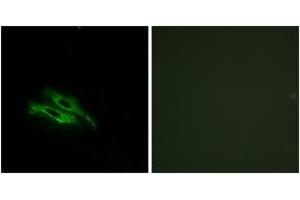 Immunofluorescence analysis of NIH-3T3 cells, using THRB Antibody. (THRB antibody  (AA 391-440))