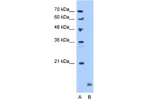 WB Suggested Anti-CRYAB Antibody Titration:  5. (CRYAB antibody  (C-Term))