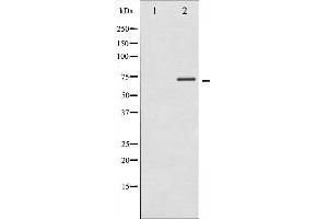 Western blot analysis of p70 S6 Kinase phosphorylation expression in Insulin treated Jurkat whole cell lysates,The lane on the left is treated with the antigen-specific peptide. (RPS6KB1 antibody  (pThr389, pThr412))