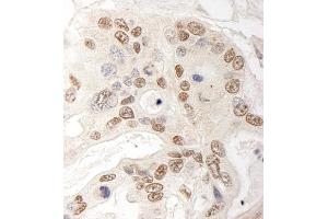 anti-Glutamine and serine Rich 1 (QSER1) (AA 1407-1457) antibody