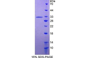 Image no. 1 for Annexin A6 (ANXA6) (AA 2-251) protein (His tag) (ABIN6236859)