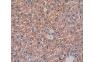 IHC-P analysis of liver tissue, with DAB staining. (Integrin beta 3 antibody  (AA 135-377))