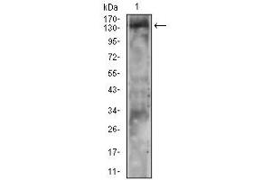 Phospholipase C gamma 2 antibody  (pTyr753)