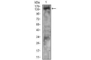 Western blot analysis using PLCG2 mouse mAb against A431 cell lysate. (Phospholipase C gamma 2 antibody  (pTyr753))