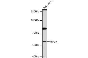 Western blot analysis of extracts of Rat spleen, using PRP19 Rabbit mAb (ABIN7269505) at 1:1000 dilution. (PRP19 antibody)